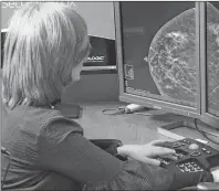  ?? AP PHOTO ?? In this Nov. 21, 2017 photo provided by the Montefiore Health System, Dr. Tova Koenigsber­g at The Montefiore Einstein Center for Cancer Care in New York shows an example of a traditiona­l mammogram scan. U.S. health officials are beginning a huge study...