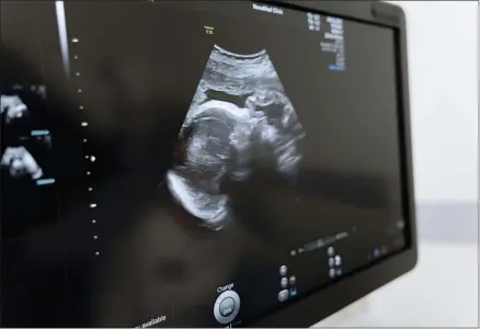  ?? PEXELS.COM ?? Pregnancy ultrasound