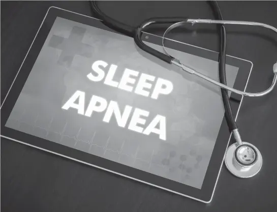  ?? TNS ?? Sleep apnea is a condition in which people repeatedly stop breathing during sleep.