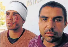  ?? (LA VOZ / ARCHIVO) ?? Golpeados. Luis Zoilo y Daniel Palacios, poco después del violento episodio con policías en Río Ceballos, en 2011.