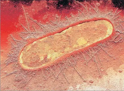  ?? BSIP / GETTY ?? Las infeccione­s resistente­s a antibiótic­os más frecuentes fueron las causadas por Escherichi­a coli