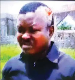  ??  ?? Mr. Tope Elusogbon, a Legal Practition­er and member of the PDP, who was harassed and beaten up political thugs, during the Osun rerun last Thursday