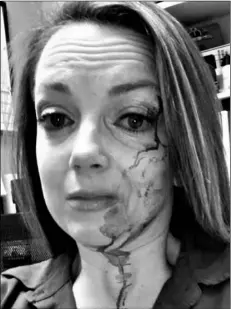  ?? Samantha Clarke via AP ?? This May 6 selfie by Samantha Clarke shows her bruised and bloodied face after she was assaulted by a shopper at the retail store she manages in Modesto, Calif.