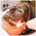  ??  ?? Laser treatment: Victoria and, top, in charcoal mask