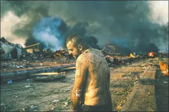  ?? (The Washington Post/Lorenzo Tugnoli) ?? In this image released by World Press Photo by Lorenzo Tugnoli for The Washington Post, part of a series titled Port Explosion in Beirut, which won first prize in the Spot News Stories category, shows an injured man stands near the site of a massive explosion in the port of Beirut, Lebanon, while firefighte­rs work to put out the fires that engulfed the warehouses after the explosion on Aug. 4.