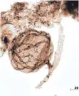  ?? FOTO: CORENTIN C LORON/UNIVERSITY OF LIÈGE ?? Mikroskopi­sche Aufnahme von einer Ourasphair­a giraldae.