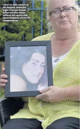  ?? STEPHEN HAMILTON ?? Carol Corr with a picture of her daughter Joleen and (right from top) the pair before and after Joleen suffered the injuries that would ultimately end her life
