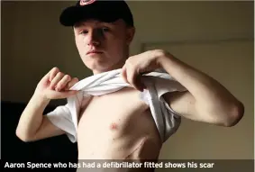  ??  ?? Aaron Spence who has had a defibrilla­tor fitted shows his scar