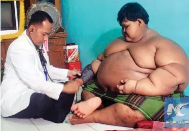  ??  ?? A Doctor checks a 10 years old Obese boy in Karawang West Java, Indonesia.