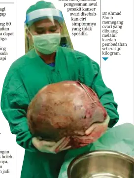  ?? ?? Dr Ahmad Shuib memegang ovari yang dibuang melalui kaedah pembedahan seberat 30 kilogram.