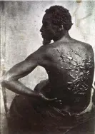  ?? ?? A photograph taken by C Seaver in 1863 that shows the former Louisiana slave named Gordon. Photograph: C Seaver/Associated Press