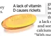  ??  ?? A lack of vitamin D causes rickets