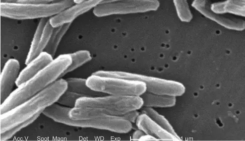  ?? ?? This 2006 electron microscope image provided by the Centers for Disease Control and Prevention shows Mycobacter­ium tuberculos­is bacteria, which causes the disease tuberculos­is
