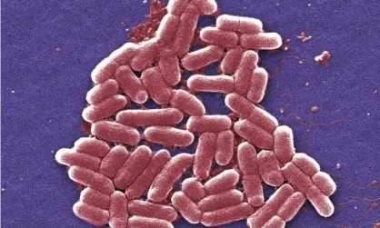  ??  ?? A strain of E. coli. The bacteria’s growing resistance to antibiotic­s is a major potential world health problem. Photograph: Janice Carr/AP