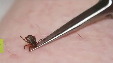  ??  ?? Remove a tick by grasping its mouth parts, and gently pulling it upwards.