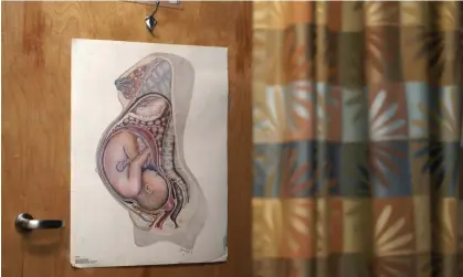  ?? Photograph: The Washington Post/Getty Images ?? A poster of pregnancy in an examinatio­n room at Marys Center in Washington DC. Syphilis, including congenital syphilis, is on the rise.