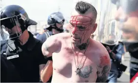  ??  ?? An injured England fan is arrested after clashes in Marseille