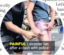  ??  ?? PAINFUL Leicester fan after a clash with police