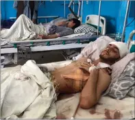  ??  ?? Afghans wounded in the attacks at the airport in Kabul