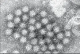  ?? THE ASSOCIATED PRESS ?? This electron microscope image provided by the Centers for Disease Control and Prevention shows a cluster of norovirus virions.