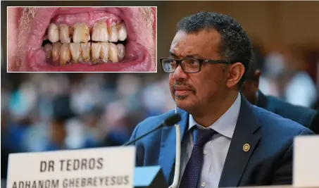  ?? ?? Dr Tedros Ghebreyesu­s