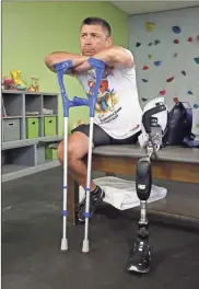  ?? Ricardo Ramirez Buxeda/Orlando Sentinel/TNS ?? Ruslan Tishchenko, at Prosthetic and Orthotic Associates in Orlando, on Thursday. Tishchenko is a sapper with the Ukrainian army, and lost his left leg in a Russian tank attack. Orlando-based nonprofit Revived Soldiers Ukraine helps rehab Ukrainian soldiers who fought against the Russian invasion.