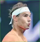  ?? FE ?? Rafael Nadal.