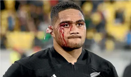  ?? GETTY IMAGES ?? Ofa Tu’ungafasi’s bloodied face and grim expression says it all as the All Blacks ponder their shock loss.