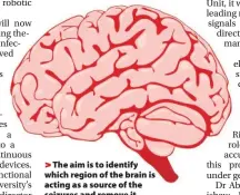  ??  ?? > The aim is to identify which region of the brain is acting as a source of the seizures and remove it