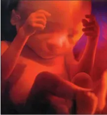  ??  ?? FEARS: A foetus at 24 weeks, the limit for abortion, which activists fear is being flouted