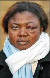  ??  ?? Hurt: Sophie Amogbokpa after the assault