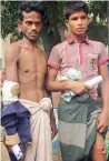  ??  ?? Amanullah, 28, and Mohammed Osama, 16, show their bullet wounds outside Sadar hospital, in Cox’s Bazar, Bangladesh, on Monday. —