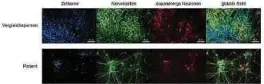  ?? Foto: LCSB ?? Mikroskopi­sche Aufnahme von Neuronen aus Hautzellen