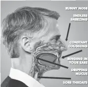  ??  ?? STUNNING HEALTH BREAKTHROU­GH: Top Doctors at a leading medical center in Minnesota have discovered that nearly 100% of nasal and sinus problems are triggered by 40 different kinds of harmful fungus that may be lurking in your mucus. Now a new treatment helps rapidly dissolve infected mucus to help you breathe easier.