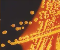  ?? (Reuters) ?? E. COLI BACTERIA colonies grown on a Hektoen enteric (HE) agar plate are seen in a microscopi­c image courtesy of the US Centers for Disease Control (CDC).