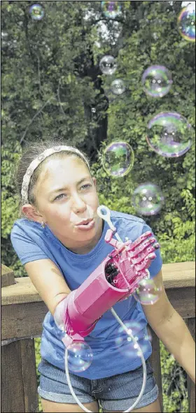  ?? ROBERT BOSTON / WASHINGTON UNIVERSITY SCHOOL OF MEDICINE ?? Washington University biomedical engineerin­g students built a robotic prosthetic arm for teen Sydney Kendall of St. Louis. Sydney requested that her new arm be pink. She lost her arm in a boating accident when she was 6.