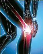  ??  ?? Osteoarthr­itis (OA) affects people mainly later in life. Changes in the joints cause the cartilage to break down. Large weight-bearing joints, like hips, knees and spines, are affected the most.