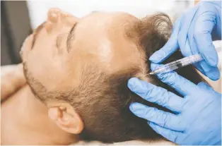  ?? ?? Treatment options, such as scalp injections undertaken by a profession­al trichologi­st, are more sophistica­ted than they once were and many can reliably promote hair growth, especially when applied early in the process.