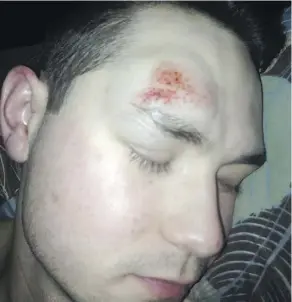  ??  ?? Adrian Cornwell says he was taken to the ground by a security guard during a March DJ event at the West Edmonton Mall water park. The incident left him with a contusion on his head.