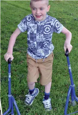  ??  ?? FIRST STEPS: Oliver on his sticks. Left: With mother Charlene