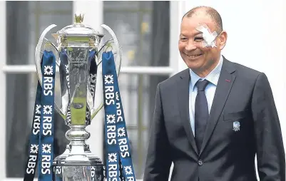  ??  ?? England coach Eddie Jones turned up for the Six Nations press launch sporting a black eye.