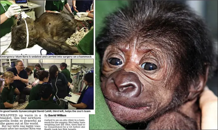  ??  ?? Emergency: Mum Kera is sedated and carried into surgery on a hammock
In good hands: Gynaecolog­ist David Cahill, third left, helps the zoo’s team
Peek-a-boo! The baby, who was born weighing just 2lb 10oz, recovers after the operation at Bristol Zoo