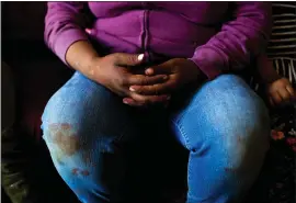  ?? PHOTOS BY RANDY VAZQUEZ — STAFF PHOTOGRAPH­ER ?? A farmworker sits next to her two daughters in the living room of her home in Watsonvill­e. Dirt and red stains line her fingernail­s from picking strawberri­es all day.