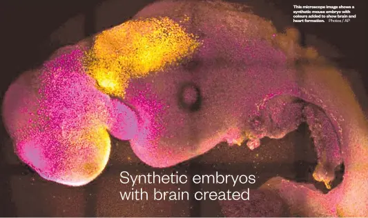  ?? Photos / AP ?? This microscope image shows a synthetic mouse embryo with colours added to show brain and heart formation.