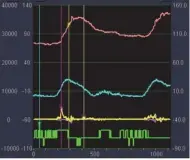  ??  ?? 注：红色为P波，蓝色为U波，黄色为WI波，绿色为模拟心电图
图 1濡脉 WI图像