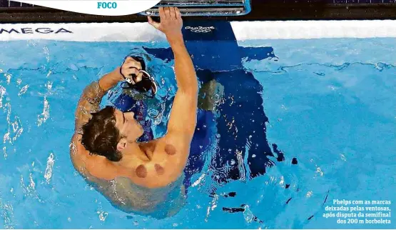  ?? Athit Perawongme­tha/Reuters ?? Phelps com as marcas deixadas pelas ventosas, após disputa da semifinal dos 200 m borboleta
