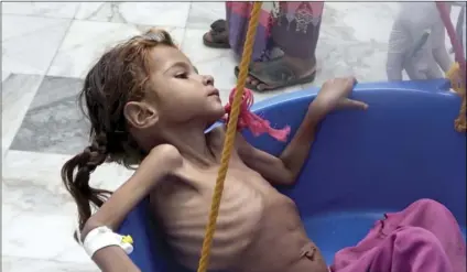  ??  ?? In this Aug. 25, file image made from video, a severely malnourish­ed seven-year-old Amal Hussein — whose name means “hope” in Arabic, is weighed at the Aslam Health Center in Hajjah, Yemen. AP PHOTO/HAMMADI ISSA