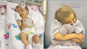  ?? NICOLAS ESPINOSA ?? Julia Espinosa, seen as a newborn and now, has survived by getting daily infusions of nutrients through an intravenou­s port in her chest. She has beaten the odds and survived because her parents have done everything within their power to help her.