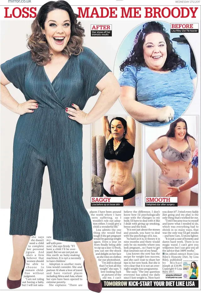  ??  ?? AFTER Star shows off her dramatic results Lisa before op on loose skin BEFORE Lisa Riley 12st 7lb heavier Delighted star after surgery SAGGY SMOOTH