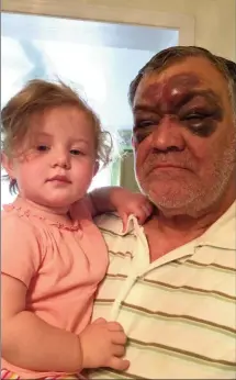 ?? Photo: Vigilance Production­s/Martin Himel ?? Andres Cedeno, a 69-year-old engineer, was injured by a police officer who threw him to the ground and restrained him in his driveway in Markham, Ont. His grandchild­ren were traumatize­d by the event.